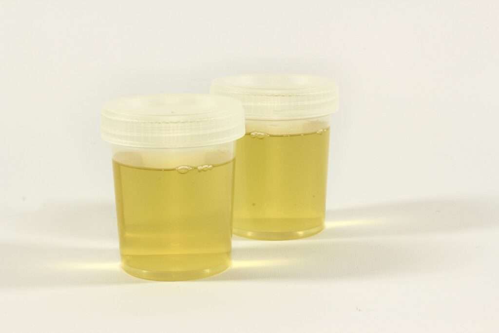 Physical Examination of Urine