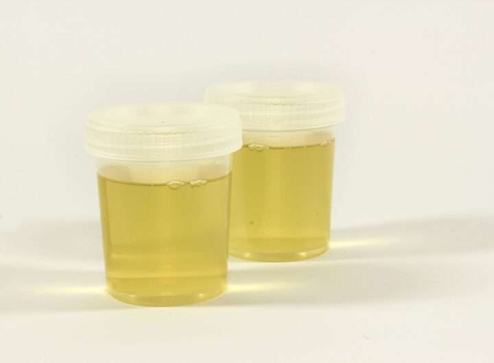 Physical Examination of Urine