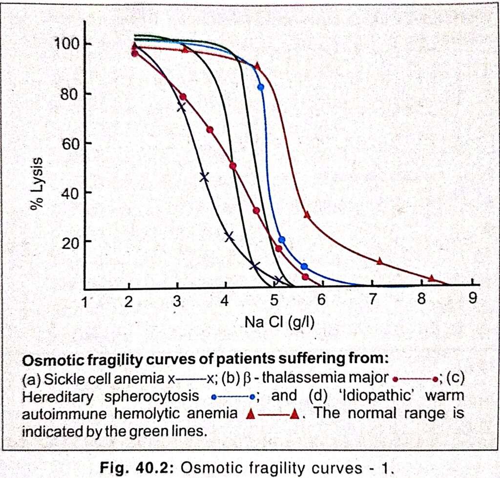 Osmotic Fragility Test Of Erythrocyte 