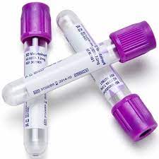 EDTA (ethylenediaminetetraacetic acid) Anticoagulant 