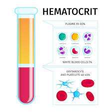 Hematocrit ( HCT ) Test