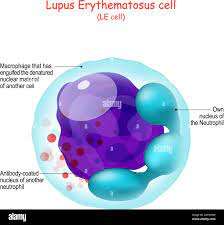 Preparation of Lupus Erythematosus (LE) Cell