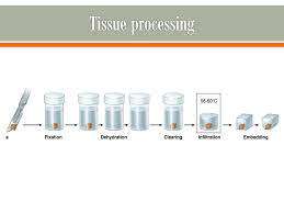 Tissue Processing