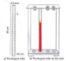 Erythrocyte Sedimentation Rate ( ESR ) Test