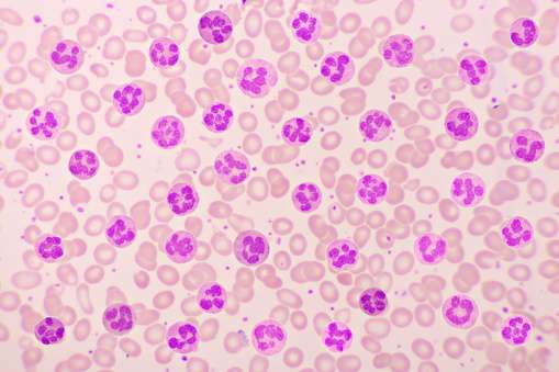 Absolute Eosinophil Count Test