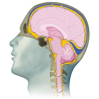 Cerebrospinal Fluid (CSF) Analysis