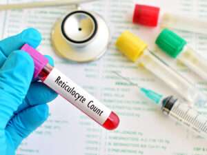 Reticulocyte Count Test