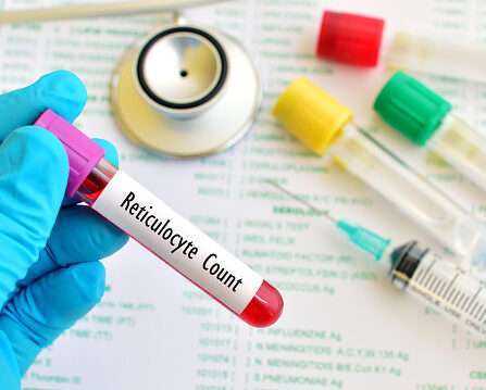 Reticulocyte Count Test