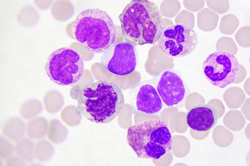 Differential Leukocyte count ( DLC ) 