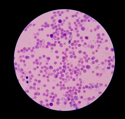 Reticulocyte Count Test 