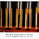 Chemical Examination of Urine Protein