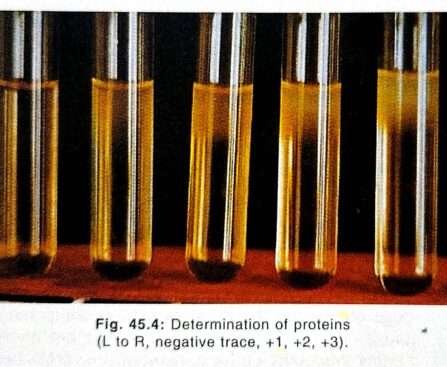 Chemical Examination of Urine Protein