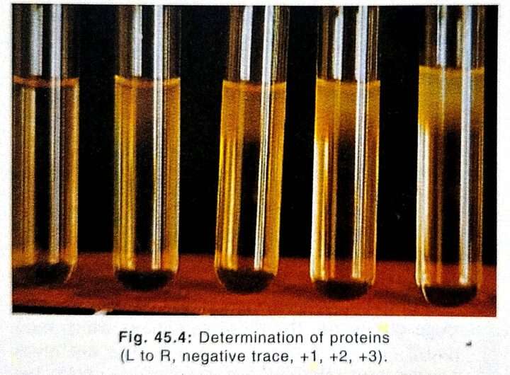 Chemical Examination of Urine Protein