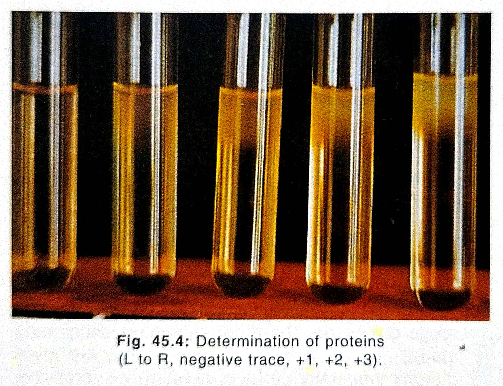 Chemical Examination of Urine Protein