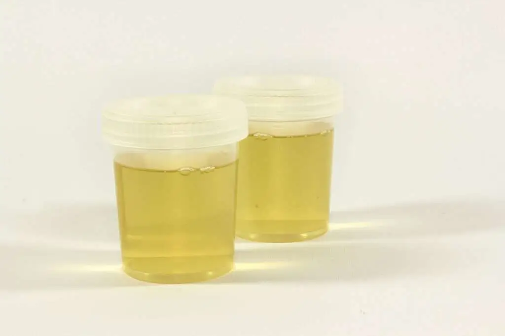 Chemical Examination of Urine Protein