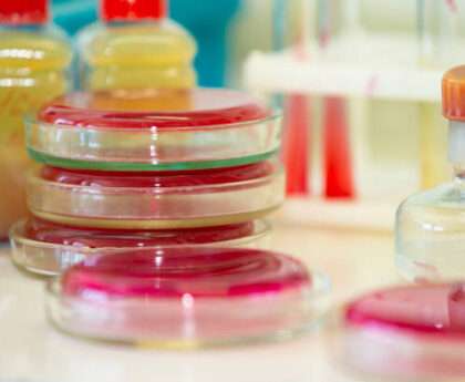 What is Culture Media in Microbiology