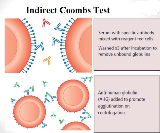 What is Indirect Coombs Test ? MLTwala Medical Lab Technician