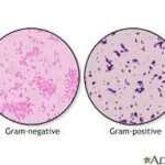 Gram Staining Method