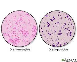 Gram Staining Method