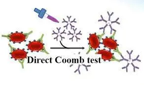 Direct Coombs Test ?